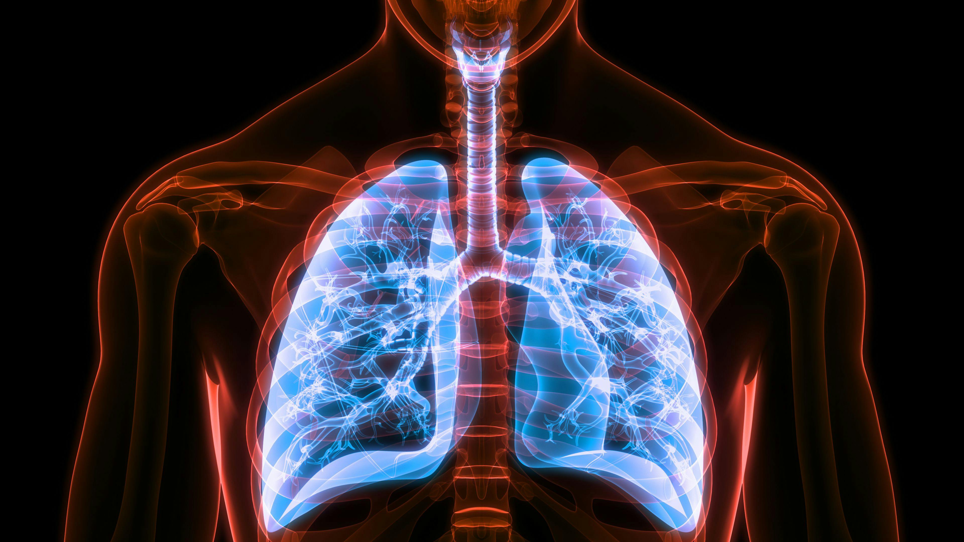 X-ray of lungs -- Image credit: magicmine | stock.adobe.com