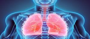 Study: Initial Severity of COVID-19 Not Associated with Later Respiratory Complications