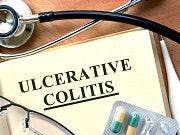 Discontinuation of Infliximab May Cause Relapse of Ulcerative Colitis