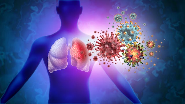 Graphic of Lung Infections With Virus | Image Credit: freshidea - stock.adobe.com