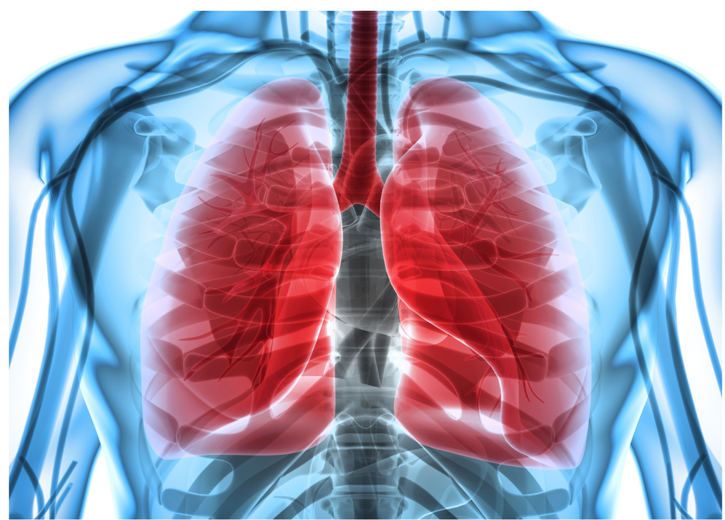 Novel Investigational Treatment Slows Lung Function Decline in Patients With Idiopathic Pulmonary Fibrosis