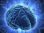 Gray Matter Degeneration Linked to Multiple Sclerosis Disability