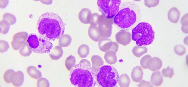 Protein Associated with Leukemia May Lead to Targeted Therapy for Currently Incurable Acute Lymphoblastic Leukemia