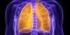 Lung Transplant Recipients with Cystic Fibrosis Commonly Resistant to Ganciclovir 