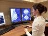 Signaling Pathway May Influence Treatment Resistant Triple Negative Breast Cancer