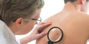 Priority Review Granted to Genentech's Combination Melanoma Therapy