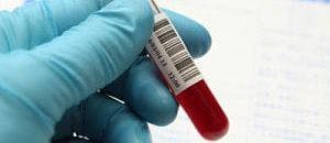 Blood Exposures Threaten Pharmacists Providing Patient Care