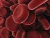 Novel Treatment Shows Promise Treating Life-threatening Blood Clotting Disorder
