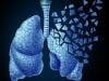 Surgery vs Radiation: Which Carries a Lower Mortality Risk for Lung Cancer?