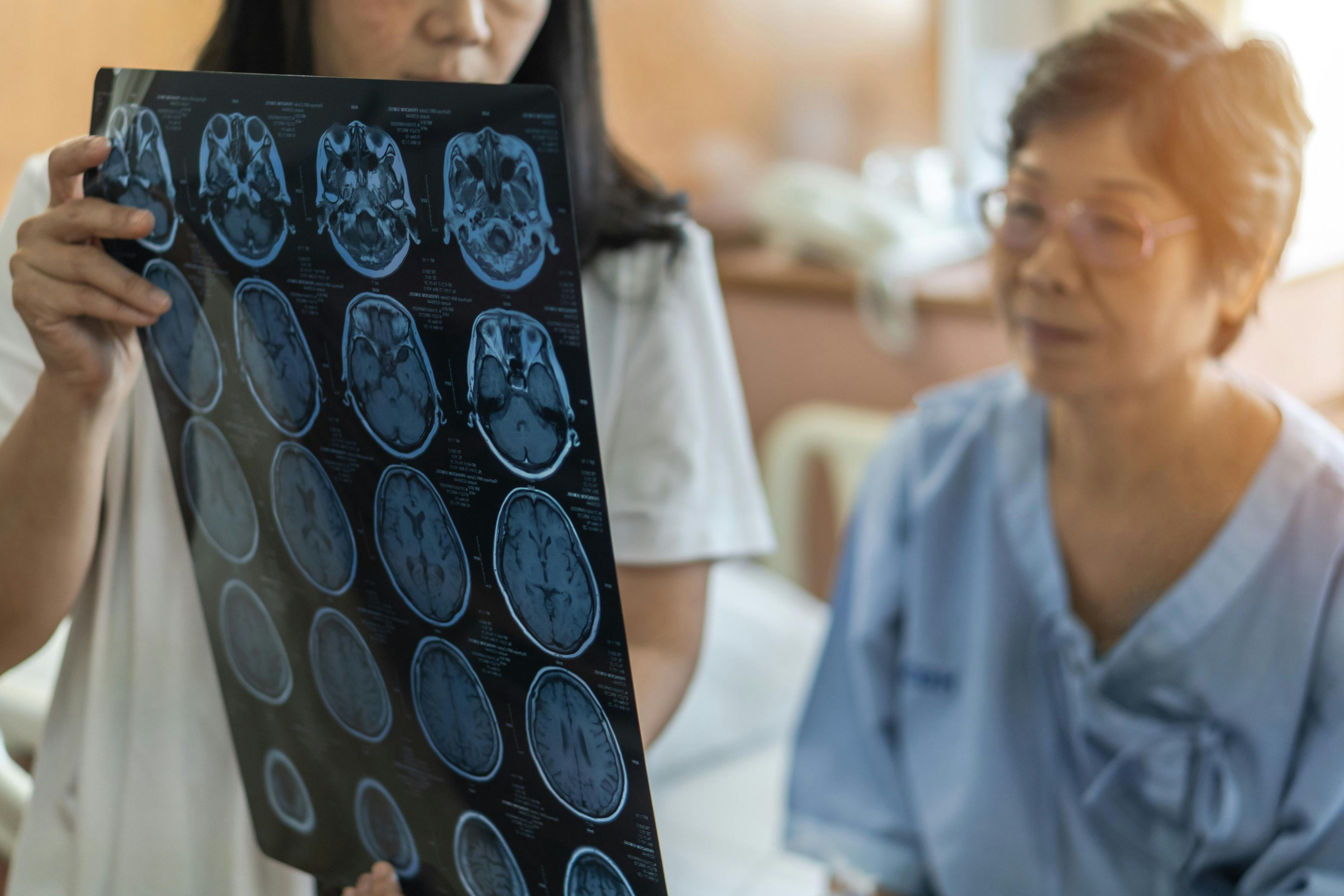 Brain disease diagnosis with medical doctor diagnosing elderly ageing patient neurodegenerative illness problem seeing Magnetic Resonance Imaging (MRI) film for neurological medical treatment - Image credit: Chinnapong | stock.adobe.com