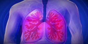 Researcher Awarded $7.5 Million in Funding for COPD Research