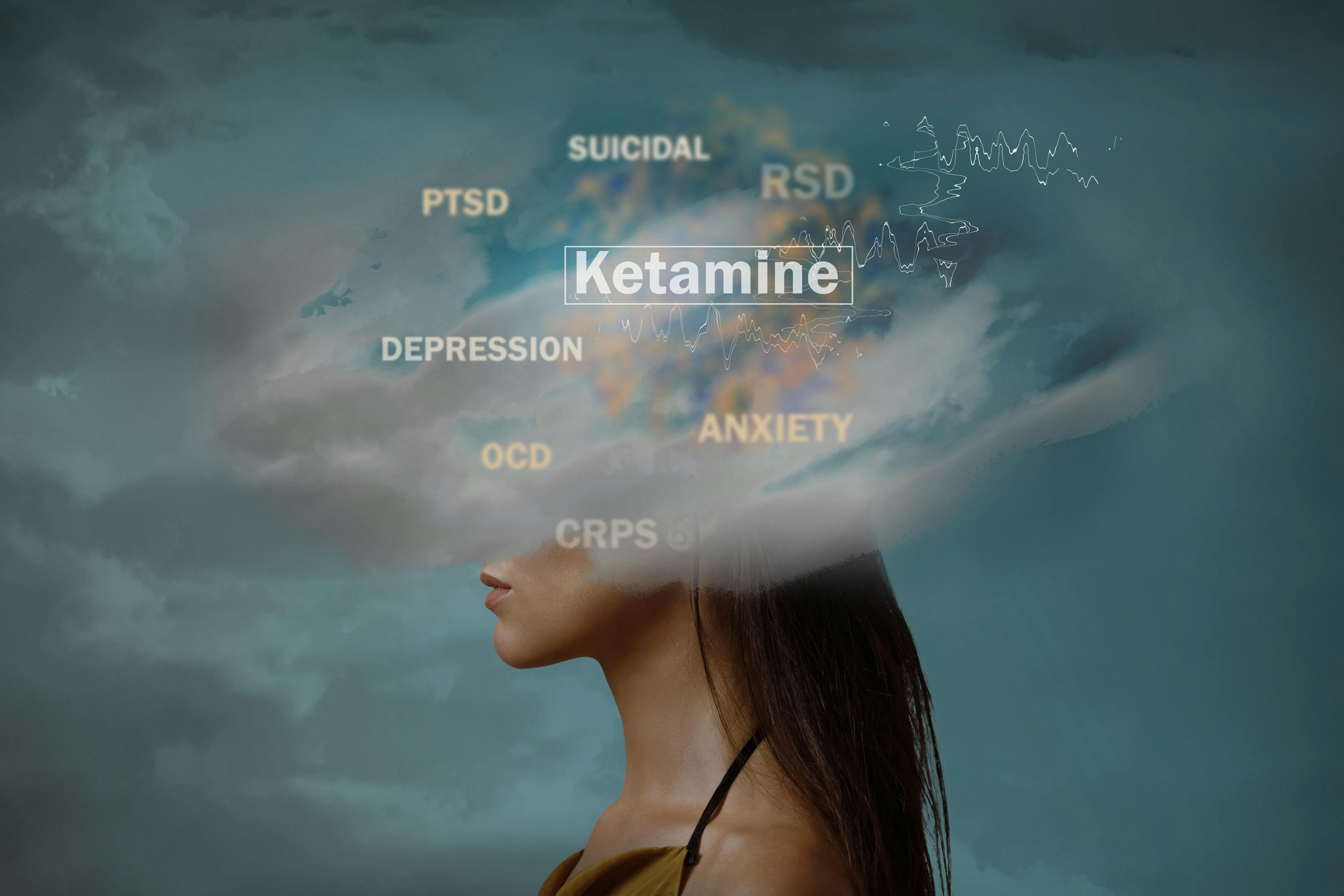 As both an off-label treatment and in the form of an FDA-approved nasal spray, ketamine is beginning to change the clinical landscape for mental health treatment, offering hope to those grappling with persistent psychological challenges. Image Credit: © Julia - stock.adobe.com