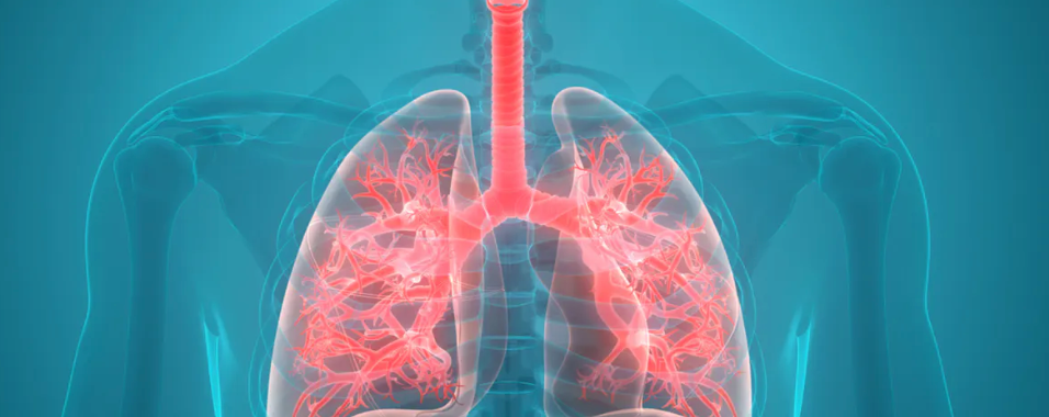 Medicaid Patients With NSCLC May Be Undertreated With Life-prolonging Targeted Therapies