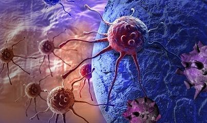 Blocking Inflammatory Pathway May Stop Brain Metastasis from Melanoma