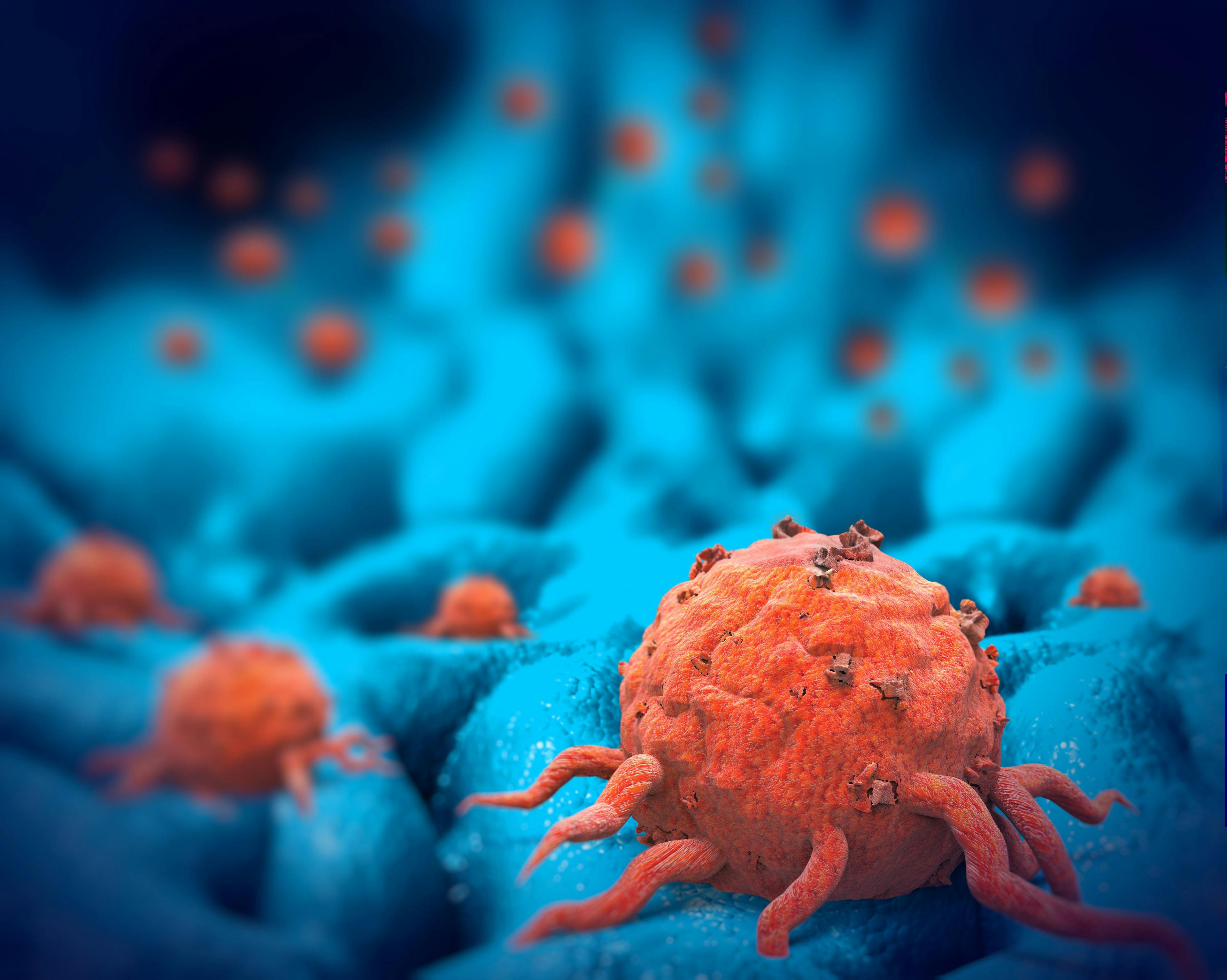 Investigational Immunotherapy Shows Promise for Treatment of Advanced Ovarian Cancer