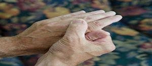 Upadacitinib Shows Promise for Treating Rheumatoid Arthritis in Certain Patients