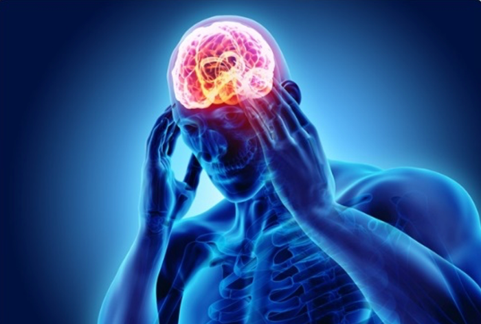 Pharmacy Clinical Pearl of the Day: Migraine Types