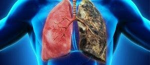 Lung Cancer Drug Receives FDA Priority Review