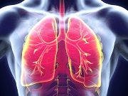 Steroids Ineffective for Chest Infections in Patients Without Lung Diseases