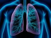 Gleevec Reduces Airway Inflammation in Severe Asthma