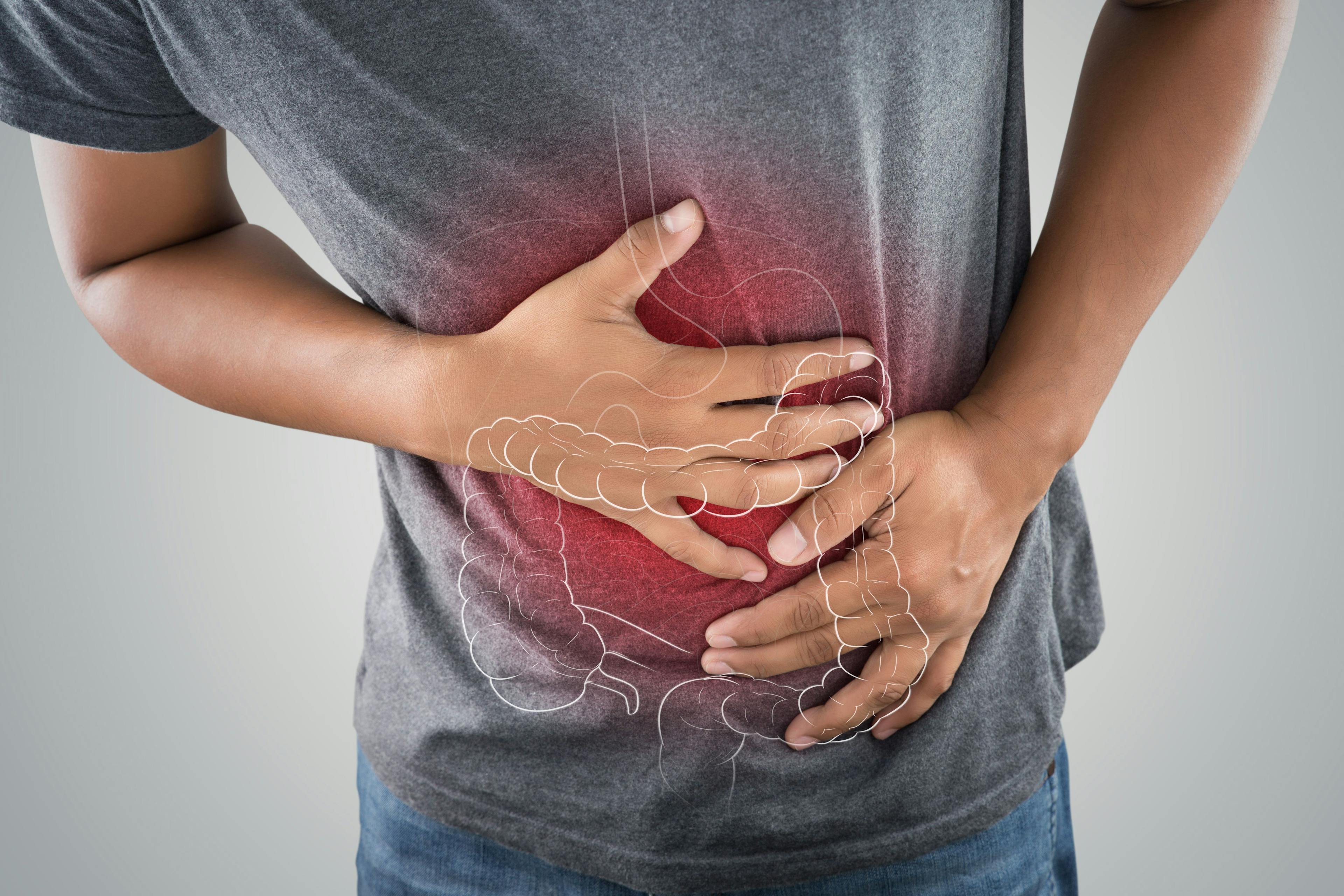 The photo of large intestine is on the man's body against gray background, People With Stomach ache problem concept, Male anatomy | Image Credit: eddows - stock.adobe.com