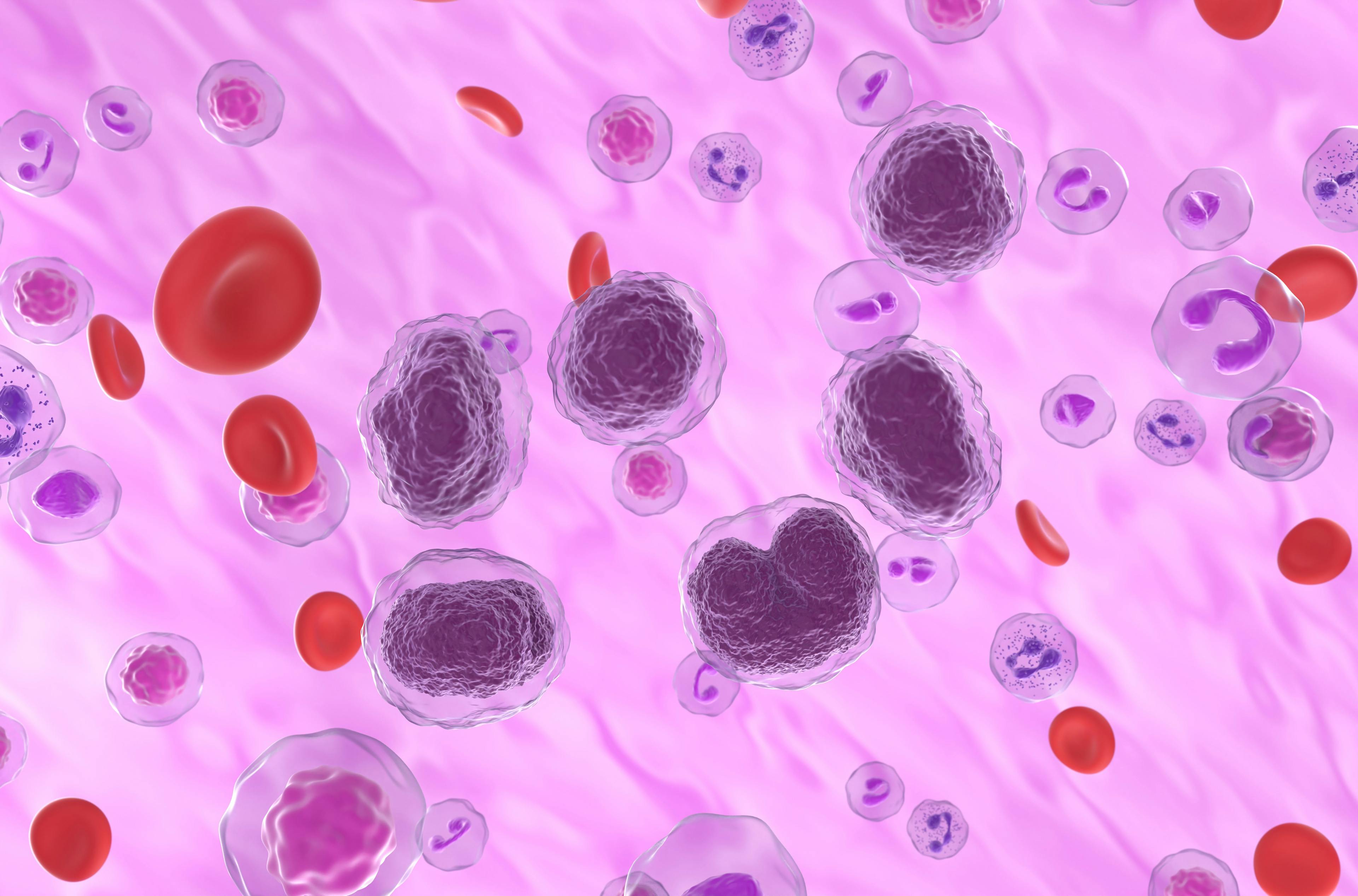 Non-hodgkin lymphoma cells in the blood flow