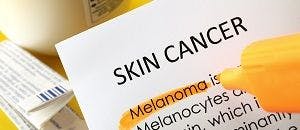 Case Report: Melanoma