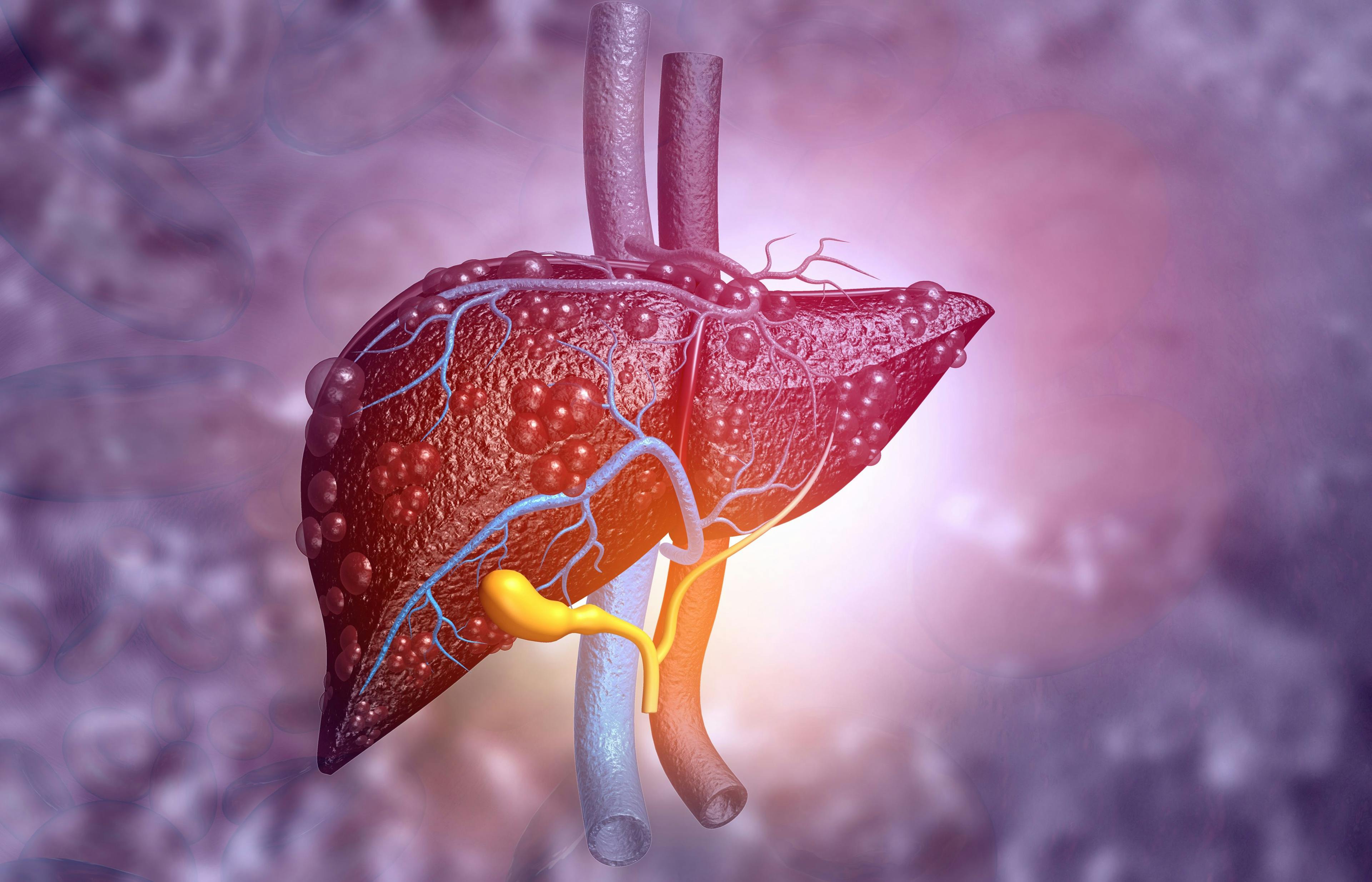 3d illustration of Abstract medical background with Diseased liver - Image credit: Rasi | stock.adobe.com 