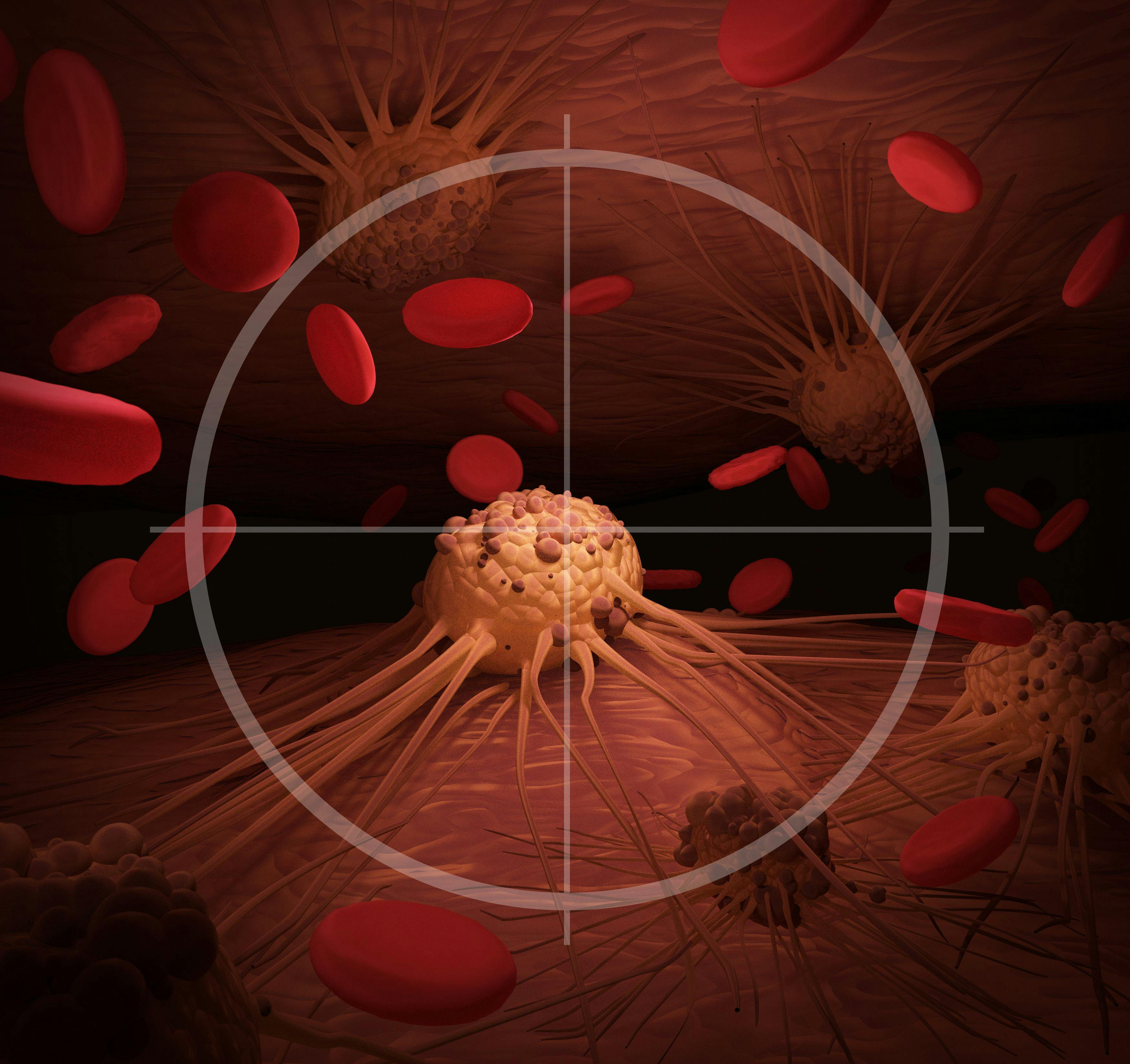 Early Results Promising for Next-Generation CAR T-cell Therapy for Solid Tumors