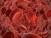 Warfarin Use in End-Stage Renal Disease Raises Concerns