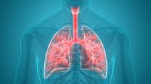 Dostarlimab Plus Chemotherapy Shows Promise in Non-Small Cell Lung Cancer 