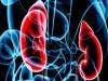 Immunotherapy Combination Doubles Response Rates in Kidney Cancer Patients