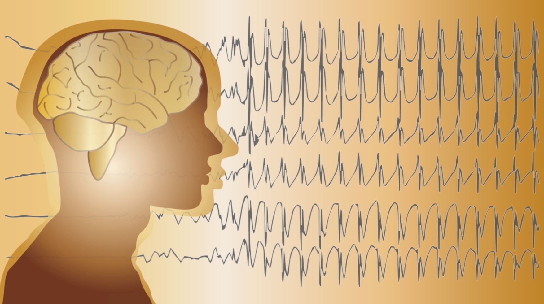 Pharmacy Clinical Pearl of the Day: Seizures  