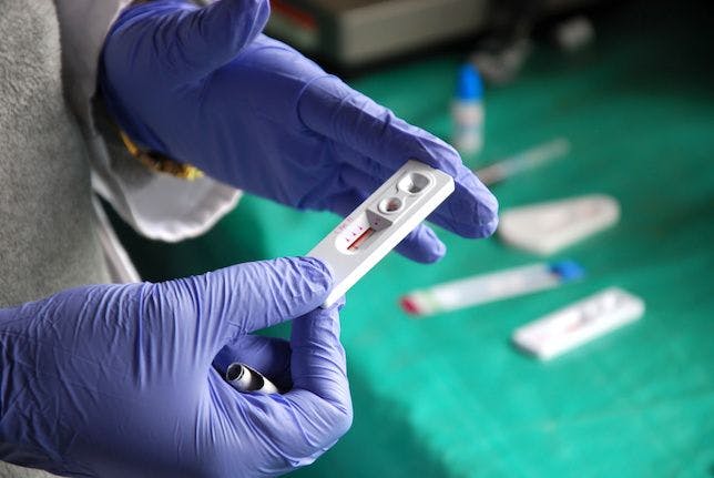 Study: Distribution of HIV Self-Tests Is Worthwhile Tool to Prevent Transmission and Raise Awareness