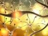 Researchers Seek to Control Multiple Sclerosis Progression