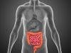 Intestinal Fungus May Trigger Gut Inflammation in Crohn's Disease