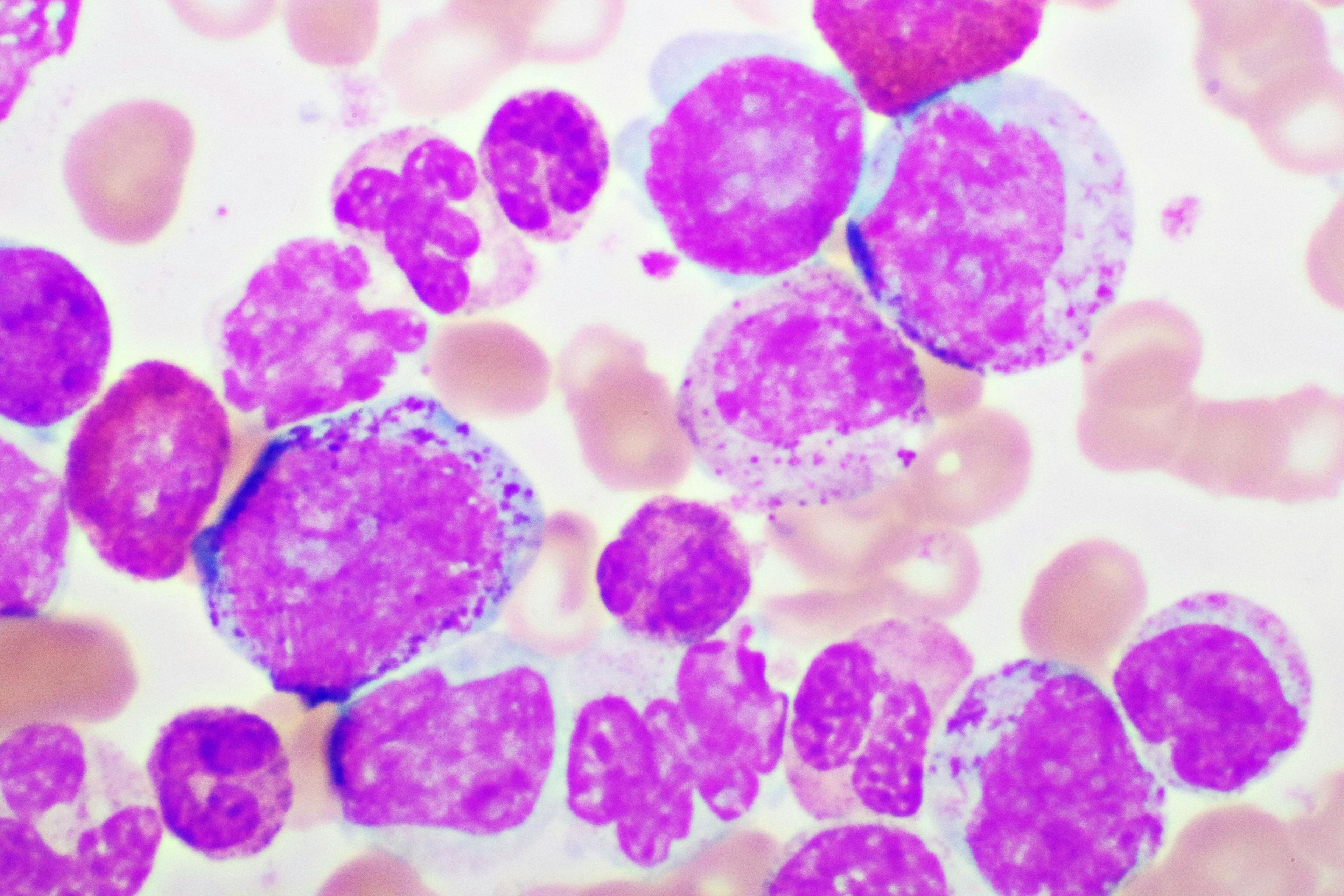 Chronic myeloid leukemia -- Image credit: jarun011 | stock.adobe.com