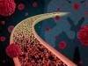 Combination Treatment May Improve Efficacy of Blood Cancer Treatment