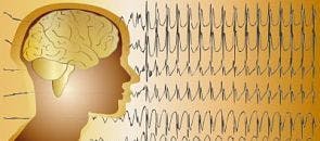 Epileptic Seizure Treatment Use Expanded by FDA
