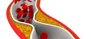 In-Depth Analysis of Amgen Cholesterol Drug Favored by FDA Panel
