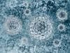How to Predict Hepatitis C Disease Progression