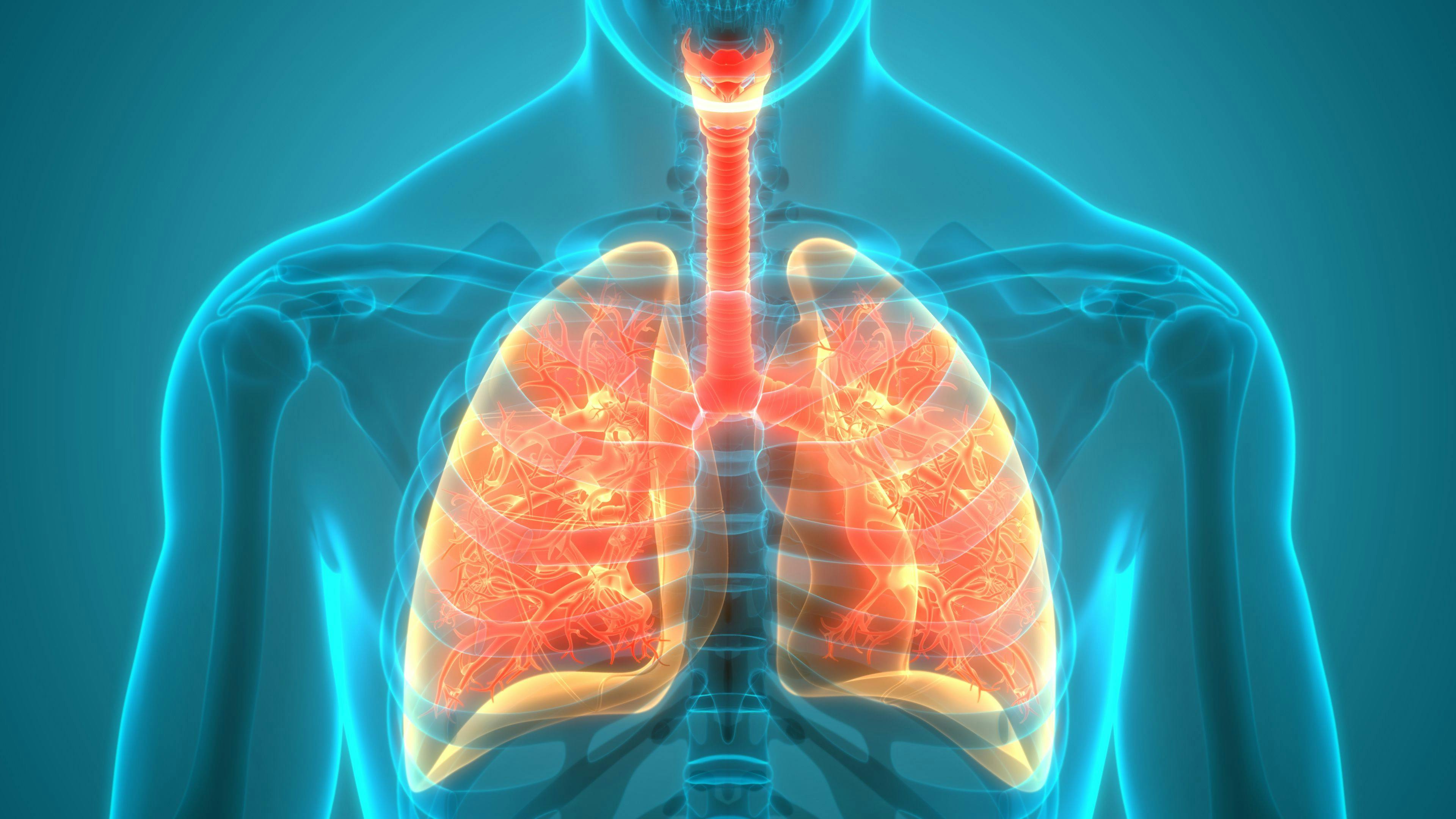 FDA Grants Priority Review to Tezepelumab for Asthma