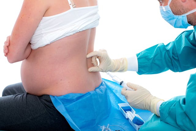 Women in labor receiving epidural -- Image credit: Firma V | stock.adobe.com
