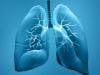 FDA Approves Treatment for Rare Lung Disease