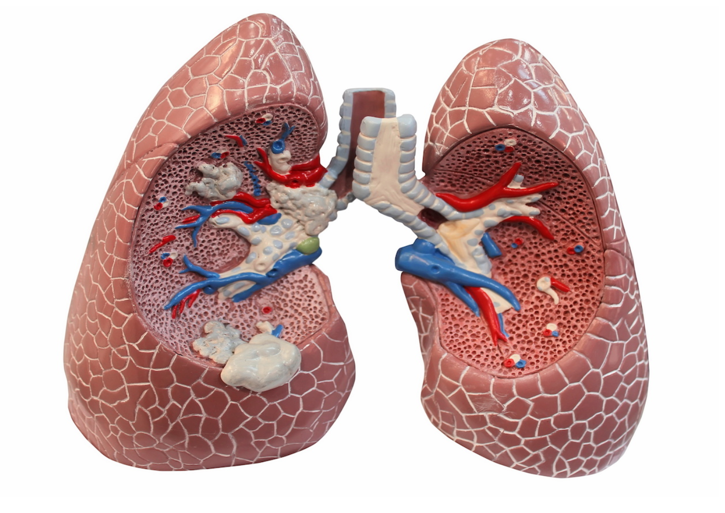 Pharmacy Clinical Pearl of the Day: COPD and FEV1/FVC