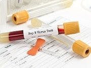 New Test Determines Response to Hepatitis B Treatment