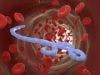Protein May Block Release of Ebola Virus, HIV
