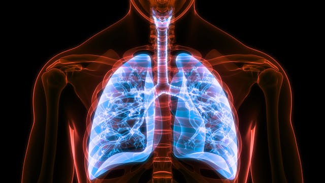 X-ray of lungs -- Image credit: magicmine | stock.adobe.com