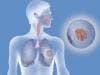 Lung Cancer Drug Extends Survival