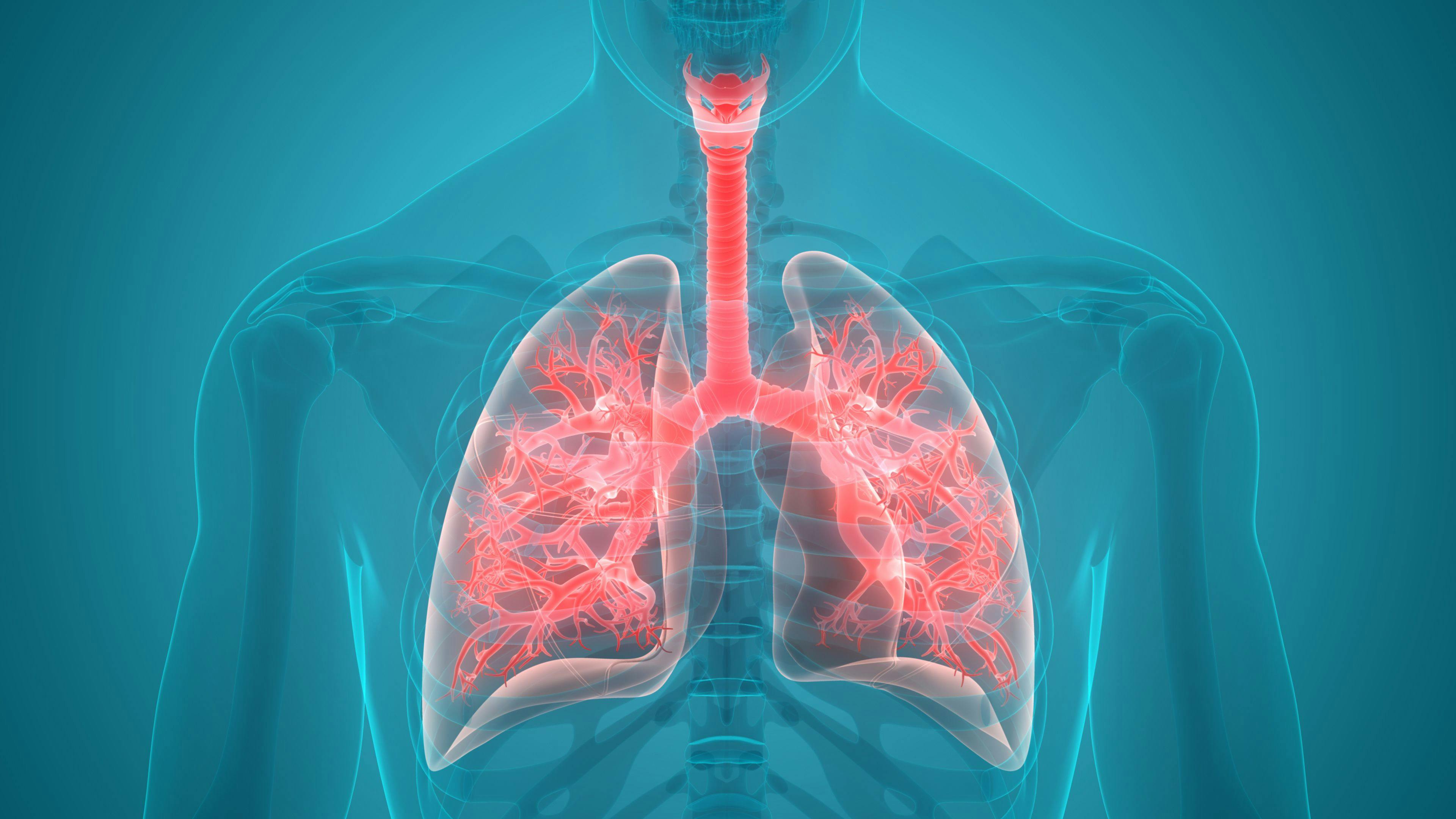 PCV13 Pneumonia Vaccine Proven Effective Against Pneumonia Requiring Oxygen Therapy